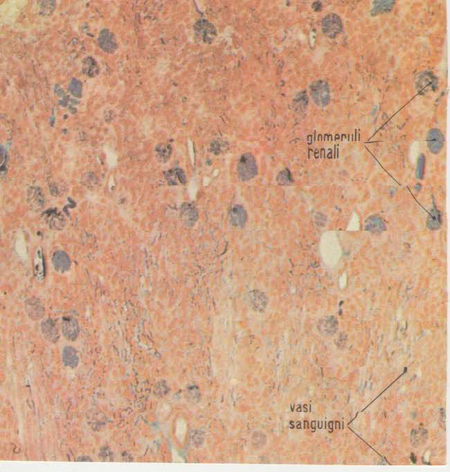 Sezione della sostanza corticale del rene