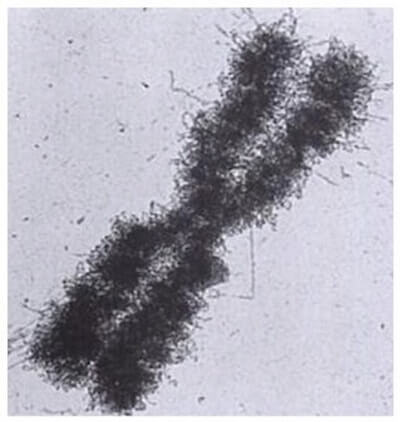 cromosoma umano