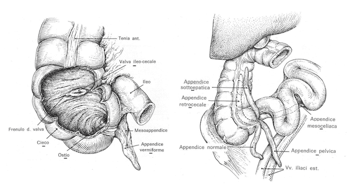 Appendice vermiforme
