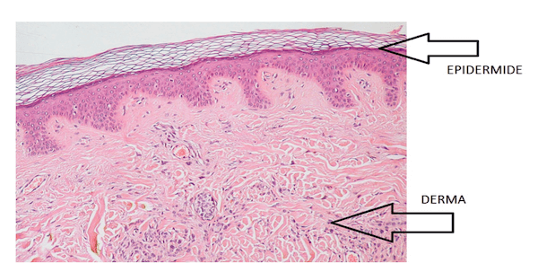 Epidermide e derma