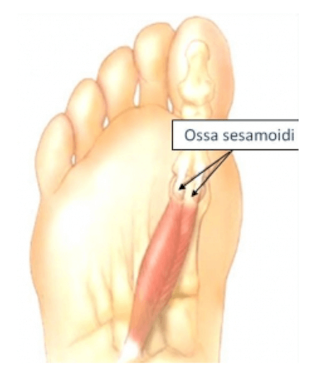 Esempio di ossa sesamoidi nel piede