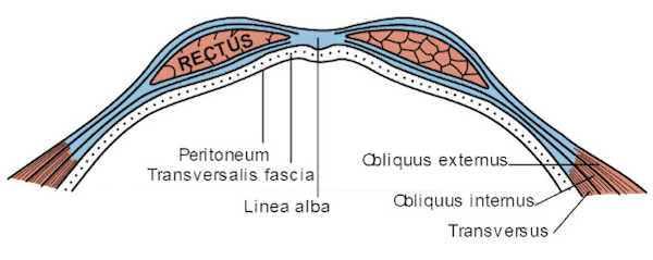 Guaina del Muscolo Retto dell'Addome