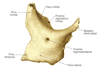 Osso Zigomatico