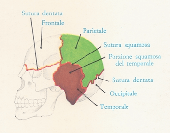 Sinartrosi