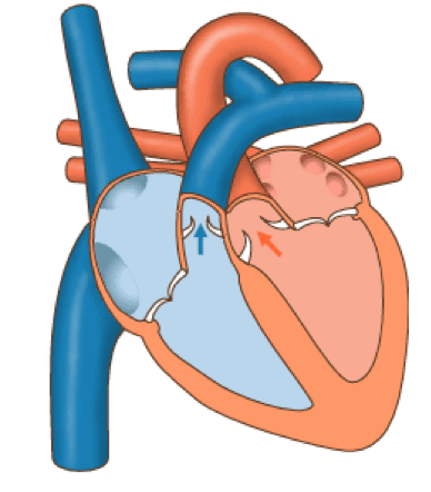 Sistole ventricolare
