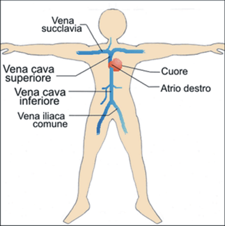 Vena cava inferiore e superiore