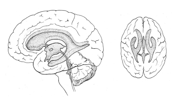 Ventricoli laterali