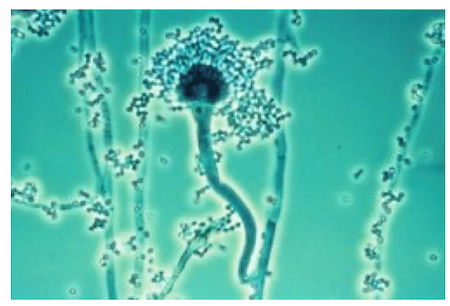 Aspergillus fumigatus