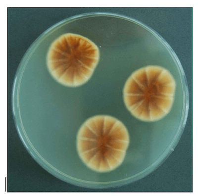 Aspergillus versicolor