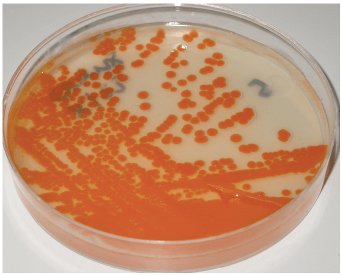 Colonie batteriche in crescita su supporto di agar arricchito