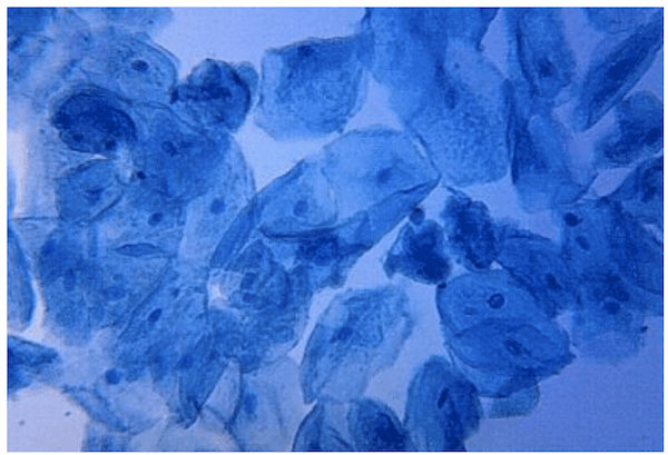 Colorazione con blu di metilene