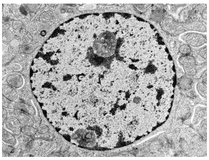 Colorazione dell'eucromatina e dell'eterocromatina