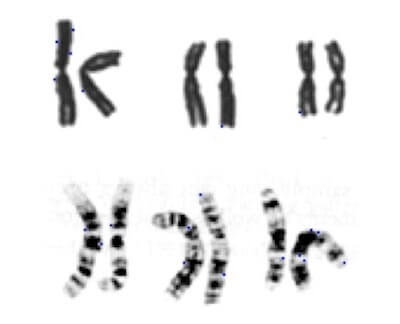 cromosomi 1, 2 e 3 con colorazione uniforme e con il tipico bandeggio ottenuto dalla colorazione di Giemsa
