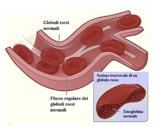 emoglobina normale