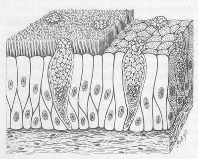 Epitelio pseudostratificato