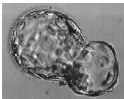 Estrusione dalla zona pellucida della blastocisti