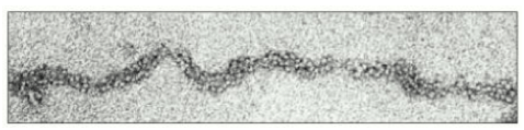 Fibra della cromatina