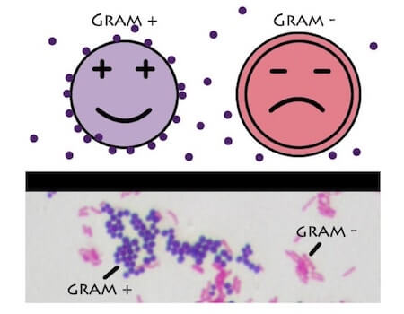 Gram / Gram-positive bacteria - Wikipedia : G) is a metric system unit of mass.