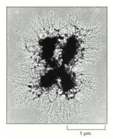 icrografia elettronica di un cromosoma metafasico di insetto