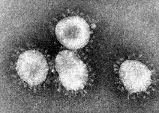 Immagine del coronavirus SARS