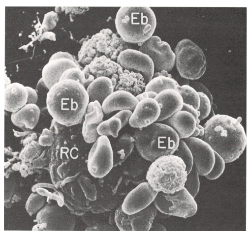 Isolotto eritroblastico