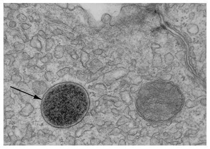 lisosoma