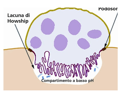 Localizzazione di un Osteoclasto