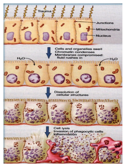 Necrosi cellulare