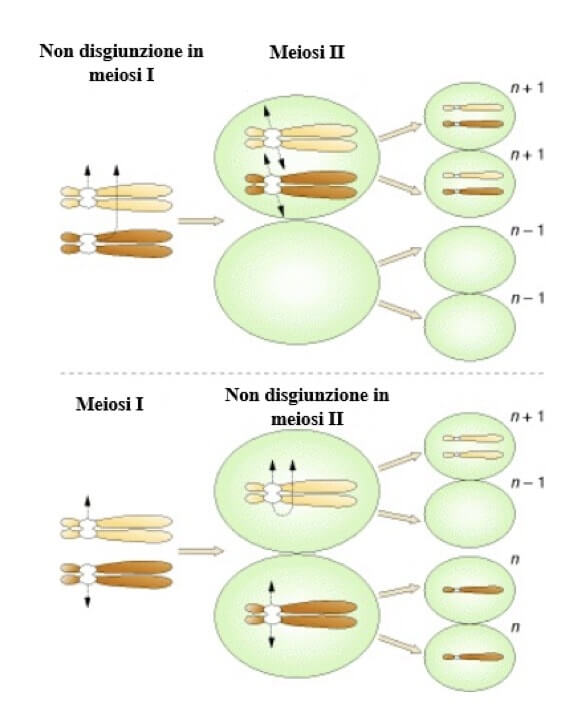 non disgiunzione nella sindrome di turner