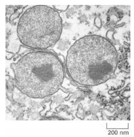 Perossisomi della cellula vegetale