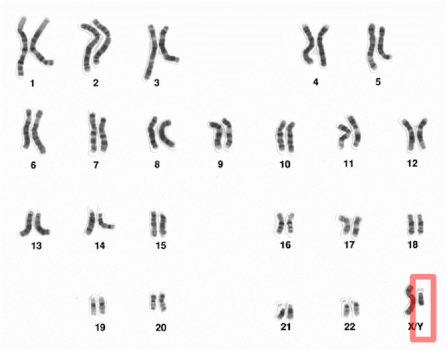 Rappresentazione dei cromosomi omologhi