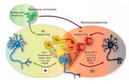 Schematizzazione del ruolo della microglia nella neuro degenerazione
