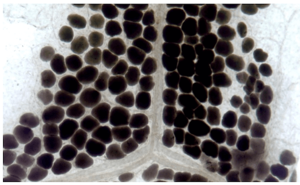 Tessuto adiposo uniloculare