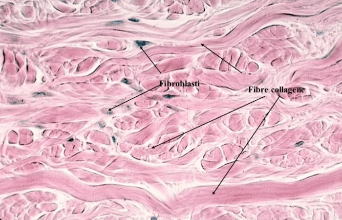 Tessuto Connettivo Fibroso Irregolare