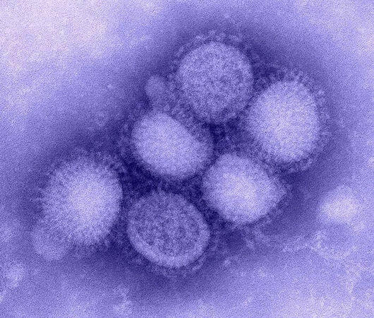 Immagine del virus dell'influenza suina