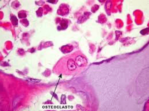 Visione istologica di un Osteoclasto